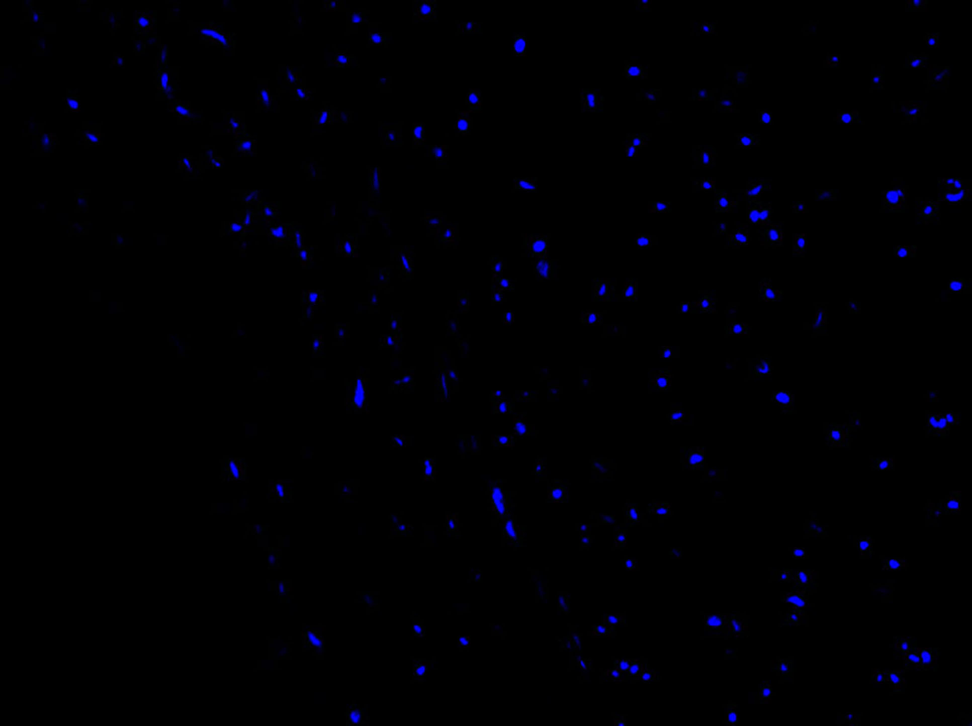 TUNEL-IF凋亡荧光法(图3)
