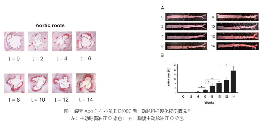 高胆固醇诱导动脉粥样硬化小鼠模型(图1)