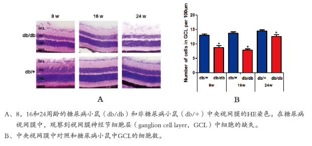 糖尿病视网膜病变实验研究(图1)