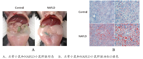  非酒精性脂肪肝实验研究(图1)