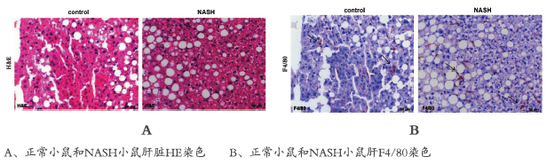  非酒精性脂肪性肝炎研究(图1)