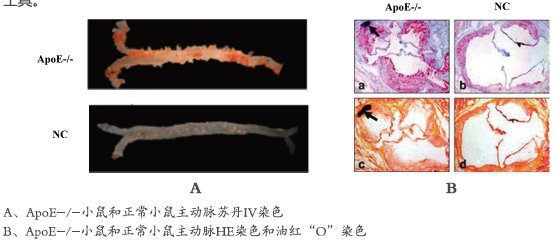  动脉粥样硬化模型研究(图1)