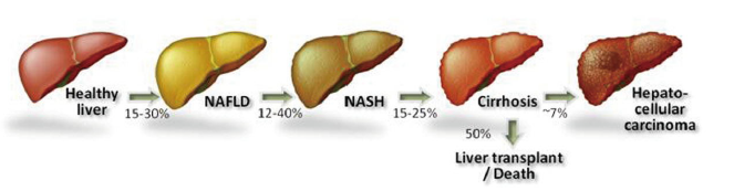 高脂高胆固醇高果糖诱导非酒精性脂肪肝模型(图1)